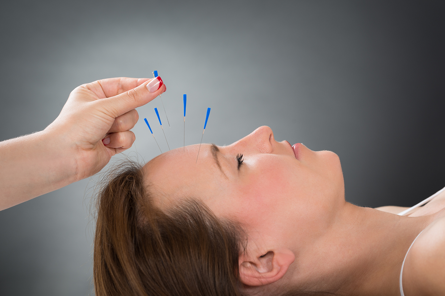 a woman getting acupuncture needles put in her forehead