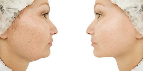 A mirror image of a woman, one side showing aged with one side looking younger.