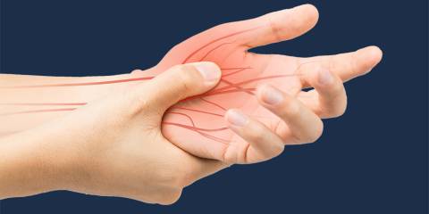 an illustration of nerves burning with pain in the hand and wrist